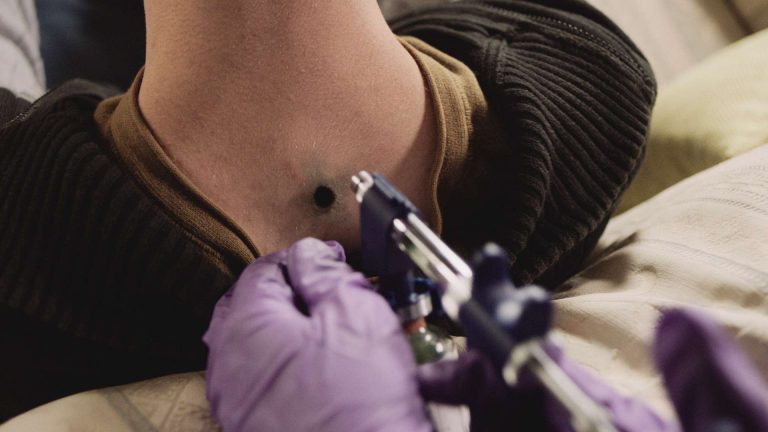 'In the flesh' visual effects shot of someone who has been injected in their lower neck with a device leaving a hole in their skin.